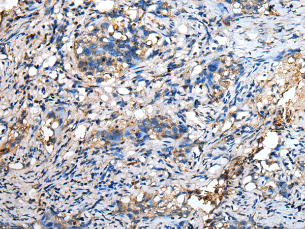 Anti-GM2A Rabbit Polyclonal Antibody