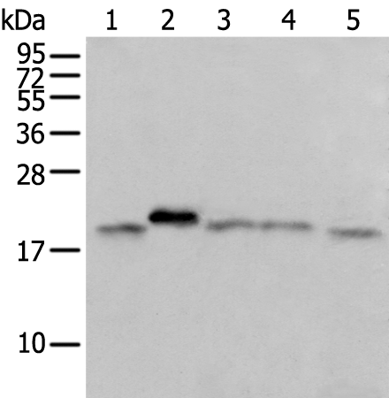 Anti-GM2A Rabbit Polyclonal Antibody