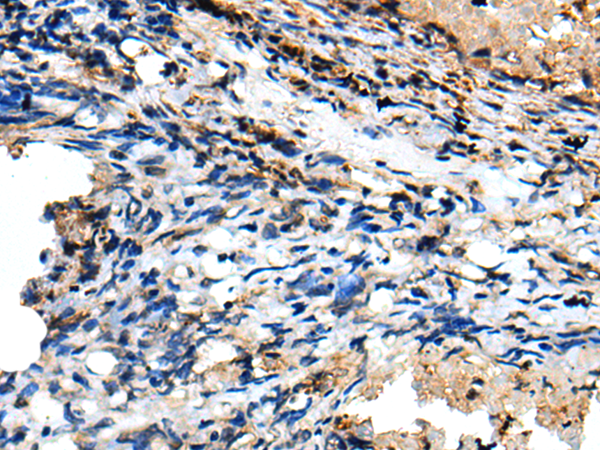 Anti-CSRP3 Rabbit Polyclonal Antibody