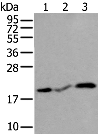 Anti-CSRP3 Rabbit Polyclonal Antibody