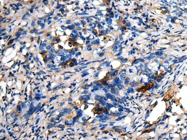 Anti-DENR Rabbit Polyclonal Antibody
