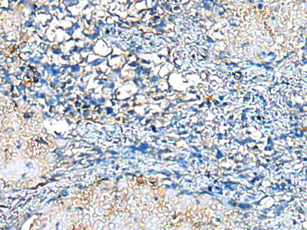 Anti-COMMD10 Rabbit Polyclonal Antibody