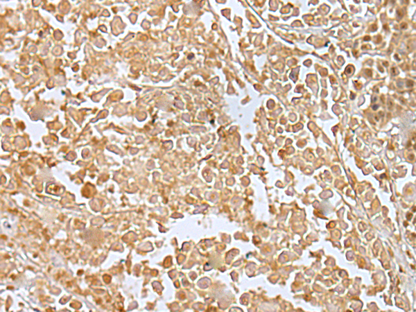 Anti-RILPL2 Rabbit Polyclonal Antibody