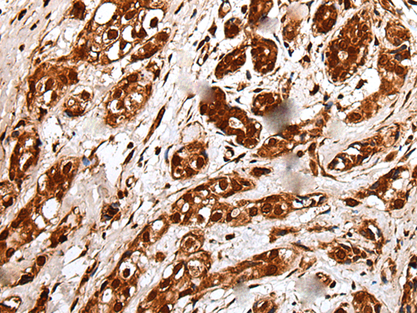 Anti-NOLA1 Rabbit Polyclonal Antibody