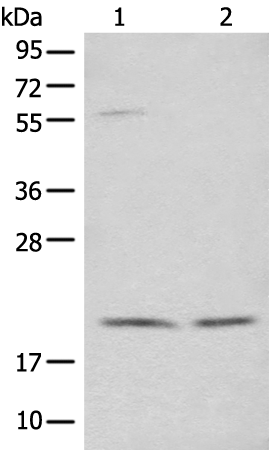 Anti-NOLA1 Rabbit Polyclonal Antibody