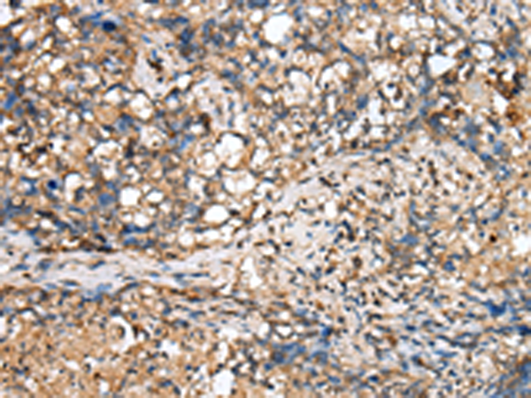 Anti-TINAGL1 Rabbit Polyclonal Antibody
