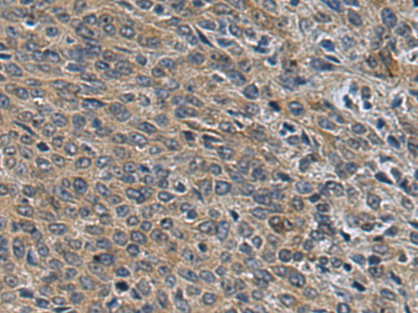 Anti-TRAPPC4 Rabbit Polyclonal Antibody