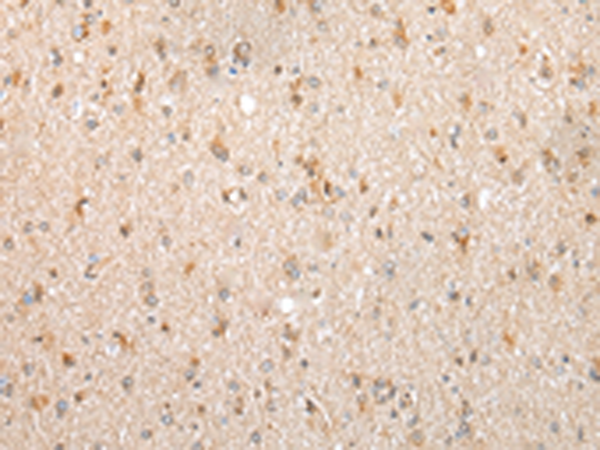 Anti-FKBP7 Rabbit Polyclonal Antibody