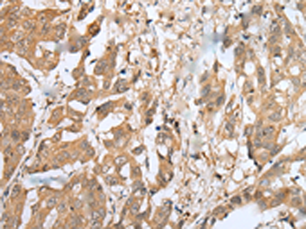 Anti-SLD5 Rabbit Polyclonal Antibody