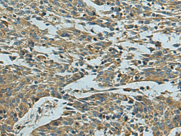 Anti-ATP6V1E2 Rabbit Polyclonal Antibody