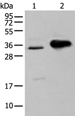 Anti-ATP6V1E2 Rabbit Polyclonal Antibody