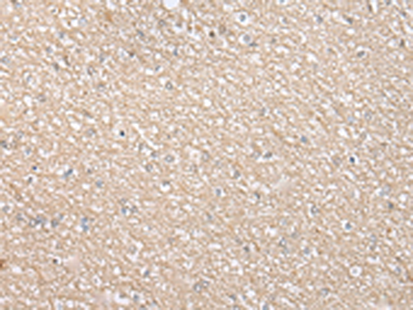 Anti-ING5 Rabbit Polyclonal Antibody