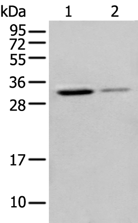 Anti-ING5 Rabbit Polyclonal Antibody