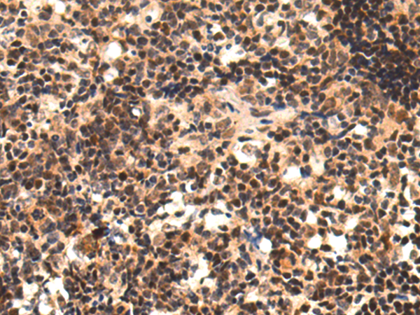 Anti-POLDIP3 Rabbit Polyclonal Antibody