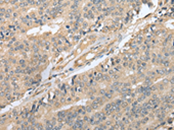 Anti-EBI3 Rabbit Polyclonal Antibody