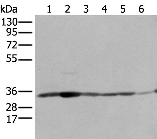 Anti-SFXN1 Rabbit Polyclonal Antibody