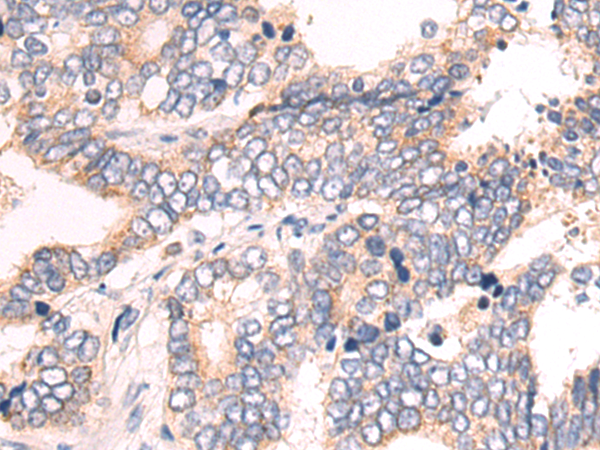 Anti-CBR4 Rabbit Polyclonal Antibody