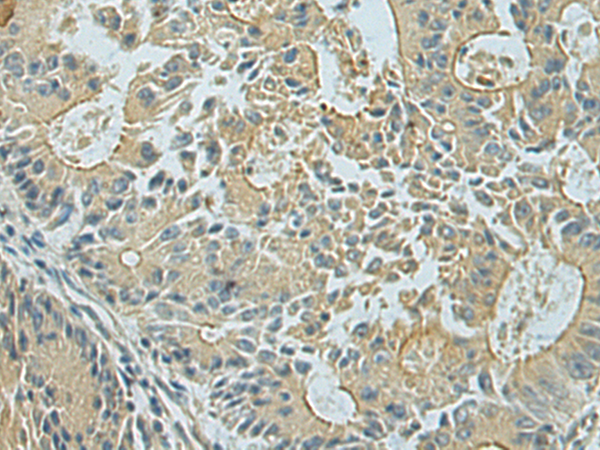 Anti-LRRC45 Rabbit Polyclonal Antibody