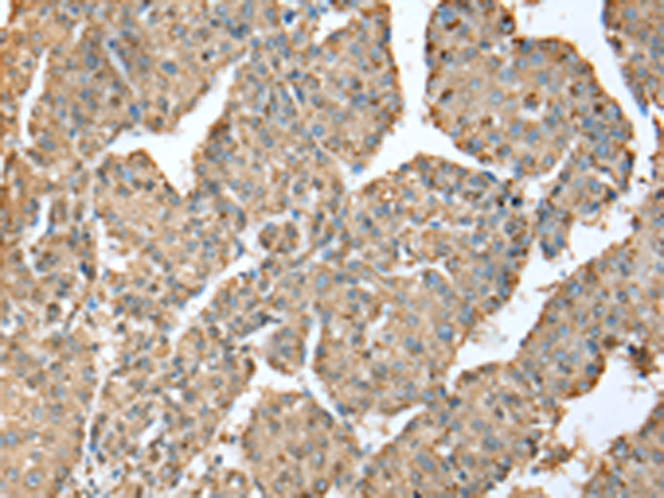 Anti-METTL7A Rabbit Polyclonal Antibody