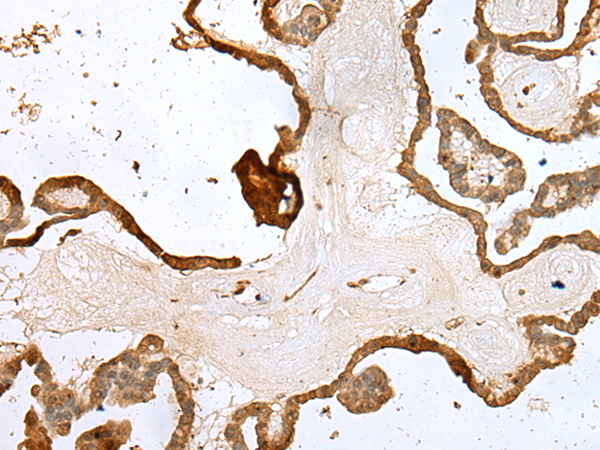 Anti-Ubiquitin Conjugating Enzyme E2 Z Rabbit Polyclonal Antibody