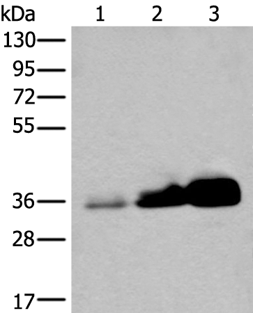 Anti-Ubiquitin Conjugating Enzyme E2 Z Rabbit Polyclonal Antibody