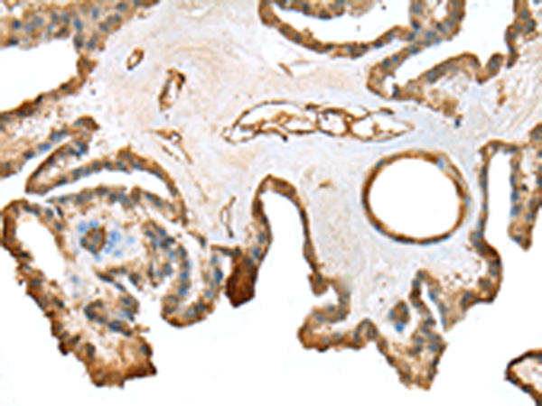 Anti-SFN Rabbit Polyclonal Antibody