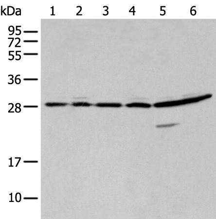 Anti-SFN Rabbit Polyclonal Antibody