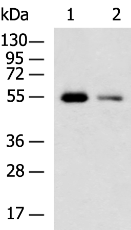 Anti-UGT3A1 Rabbit Polyclonal Antibody
