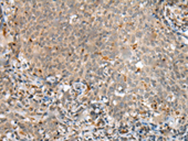 Anti-ASB9 Rabbit Polyclonal Antibody