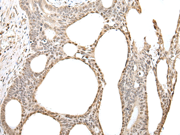Anti-ZBTB5 Rabbit Polyclonal Antibody