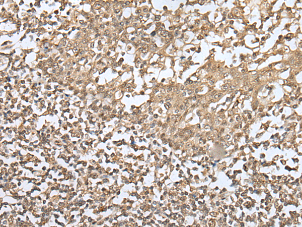 Anti-ZKSCAN1 Rabbit Polyclonal Antibody