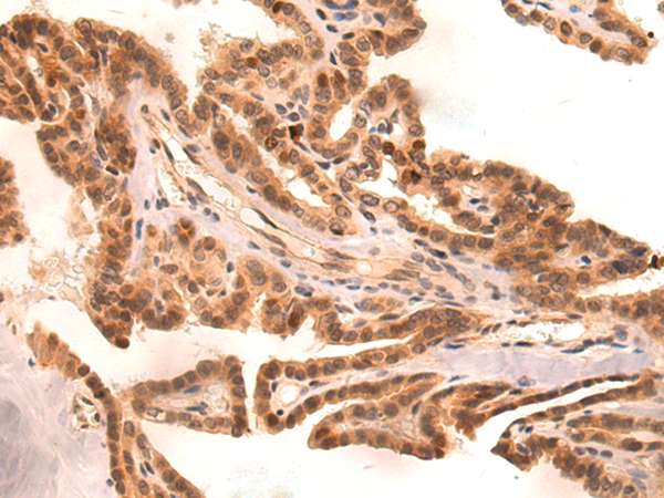 Anti-ZKSCAN3 Rabbit Polyclonal Antibody