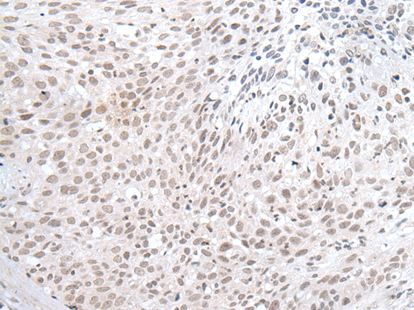 Anti-ZNF131 Rabbit Polyclonal Antibody