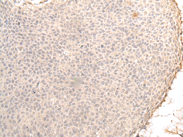 Anti-ZNF263 Rabbit Polyclonal Antibody