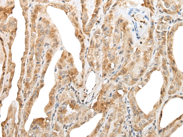 Anti-ZNF8 Rabbit Polyclonal Antibody