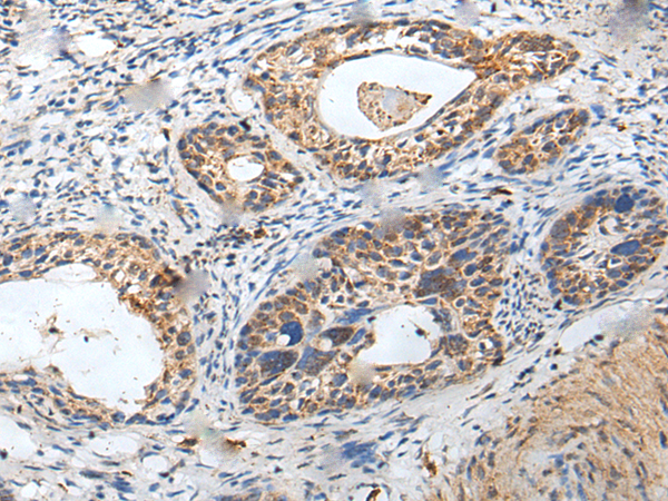 Anti-ZPBP Rabbit Polyclonal Antibody