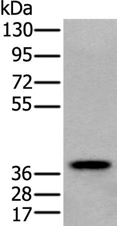 Anti-ZPBP Rabbit Polyclonal Antibody
