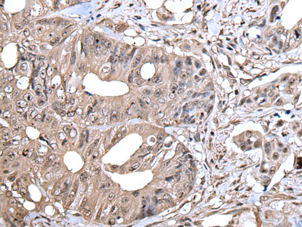 Anti-ZYX Rabbit Polyclonal Antibody