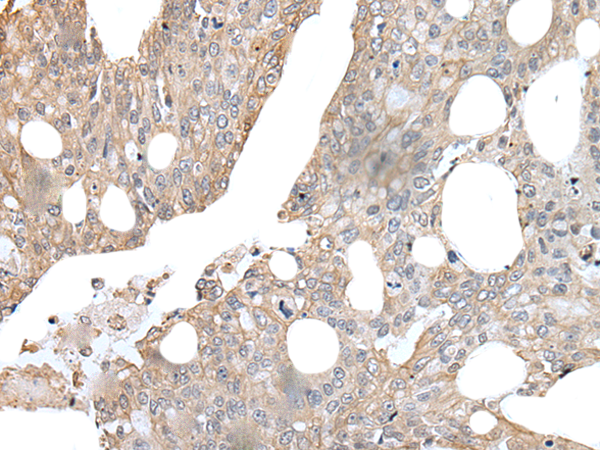 Anti-XPNPEP2 Rabbit Polyclonal Antibody