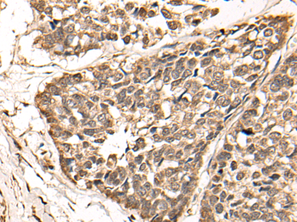 Anti-WDFY3 Rabbit Polyclonal Antibody