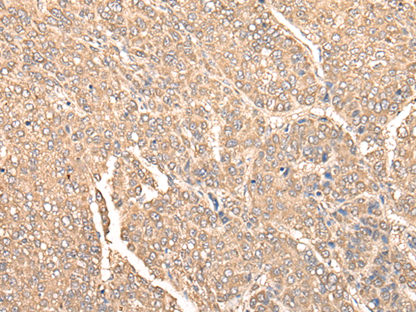 Anti-FENS1 Rabbit Polyclonal Antibody