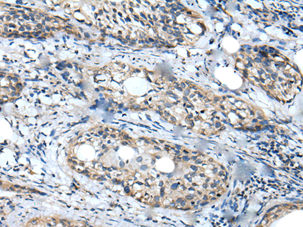Anti-WDFY2 Rabbit Polyclonal Antibody