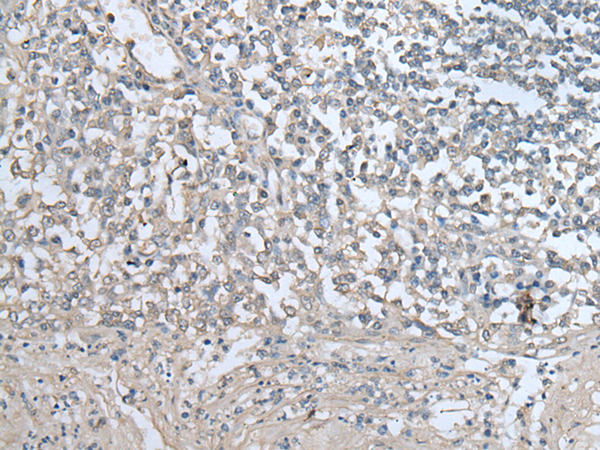 Anti-UAP1 Rabbit Polyclonal Antibody