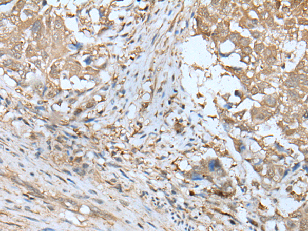 Anti-Ubiquitin Activating Enzyme 5 Rabbit Polyclonal Antibody