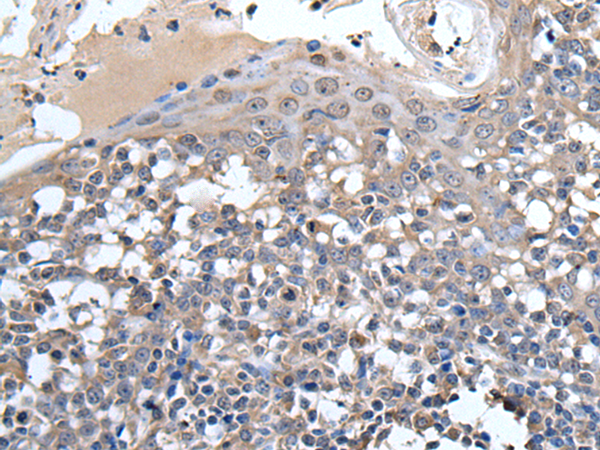Anti-Ubiquitin Conjugating Enzyme E2 D3 Rabbit Polyclonal Antibody