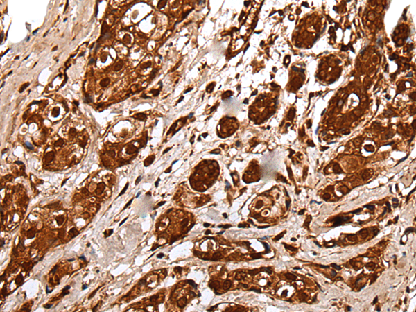 Anti-Ubiquitin Conjugating Enzyme E2 Variant 1 Rabbit Polyclonal Antibody