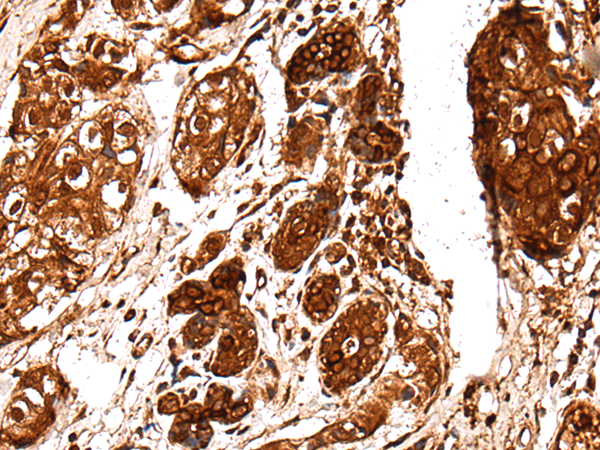 Anti-Ubiquitin Conjugating Enzyme E2 Variant 2 Rabbit Polyclonal Antibody