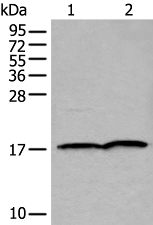Anti-Ubiquitin Conjugating Enzyme E2 Variant 2 Rabbit Polyclonal Antibody