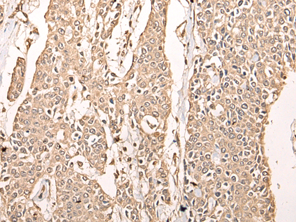 Anti-ATAD3A Rabbit Polyclonal Antibody