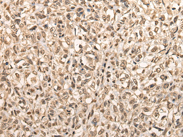 Anti-BarX1 Rabbit Polyclonal Antibody